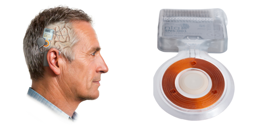 Breakthrough Device Designation Granted to AI-Guided Brain Implant for Memory Loss